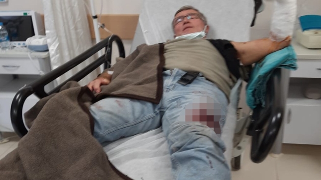 Antalya'da pitbull saldırısına uğrayan adam hastaneye kaldırıldı