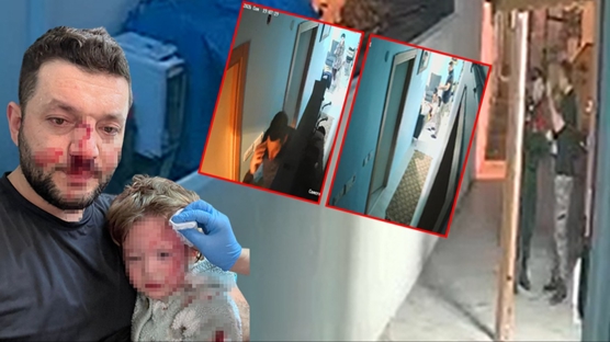T�rkiye'yi aya�a kald�ran olay! Bebe�in darp edildi�i kavgan�n g�r�nt�leri ortaya ��kt�